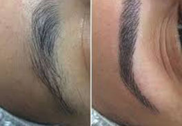 Micropigmentação compacta