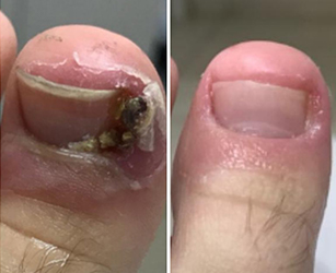 Imagem unha criança